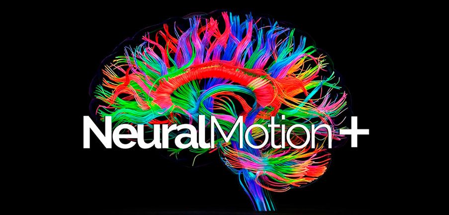 img-neural-motion04